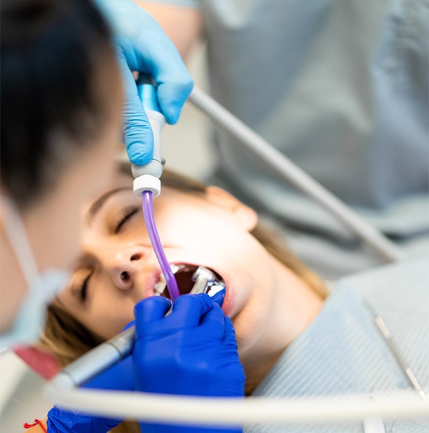 horizon dental care root canal therapy