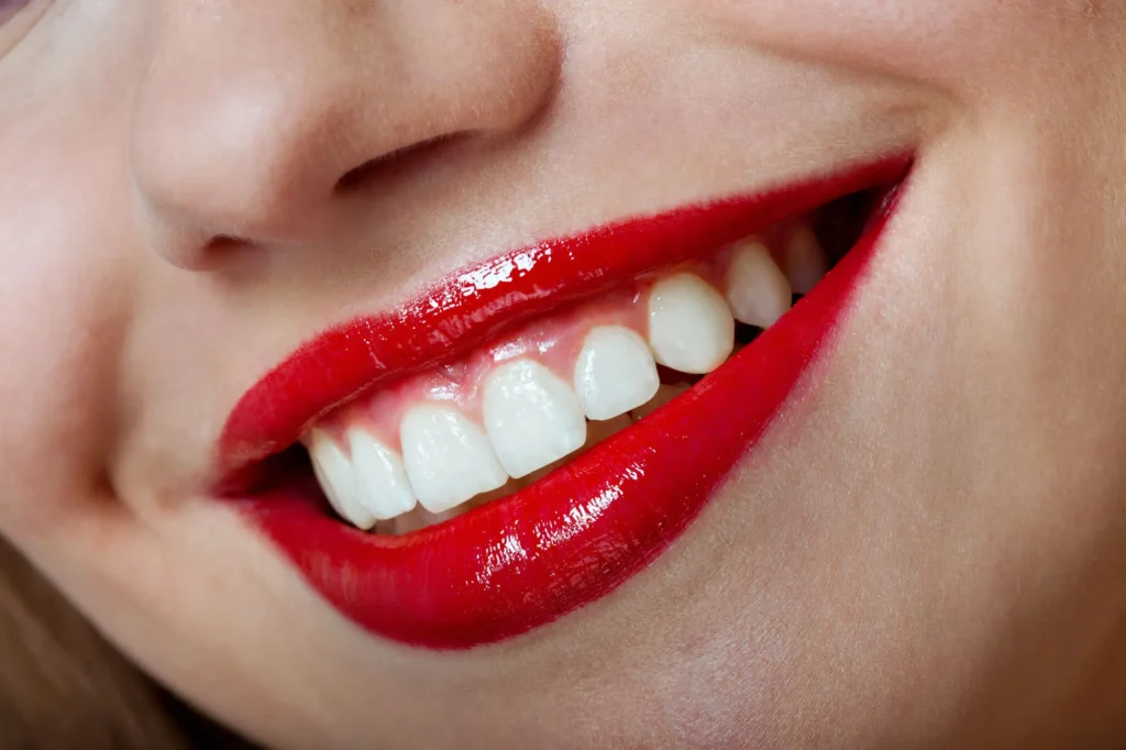 cosmetic dentist miramar places veneers successfully