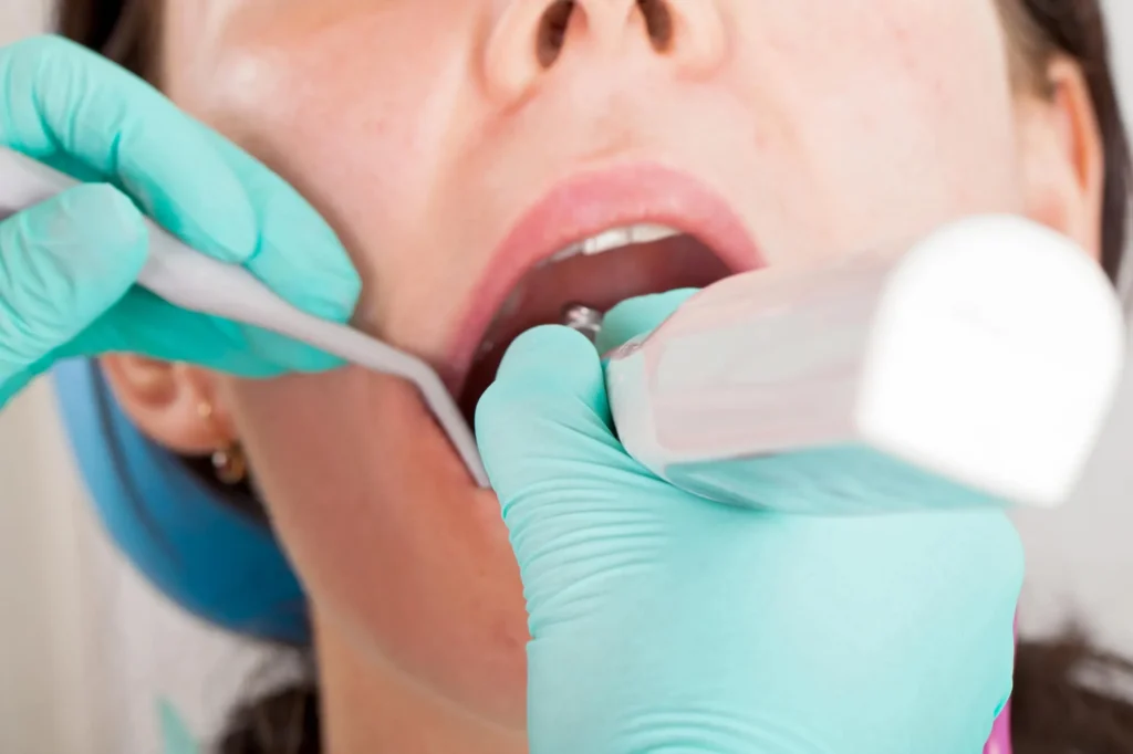 emergency dentist mirama checking patient's teeth