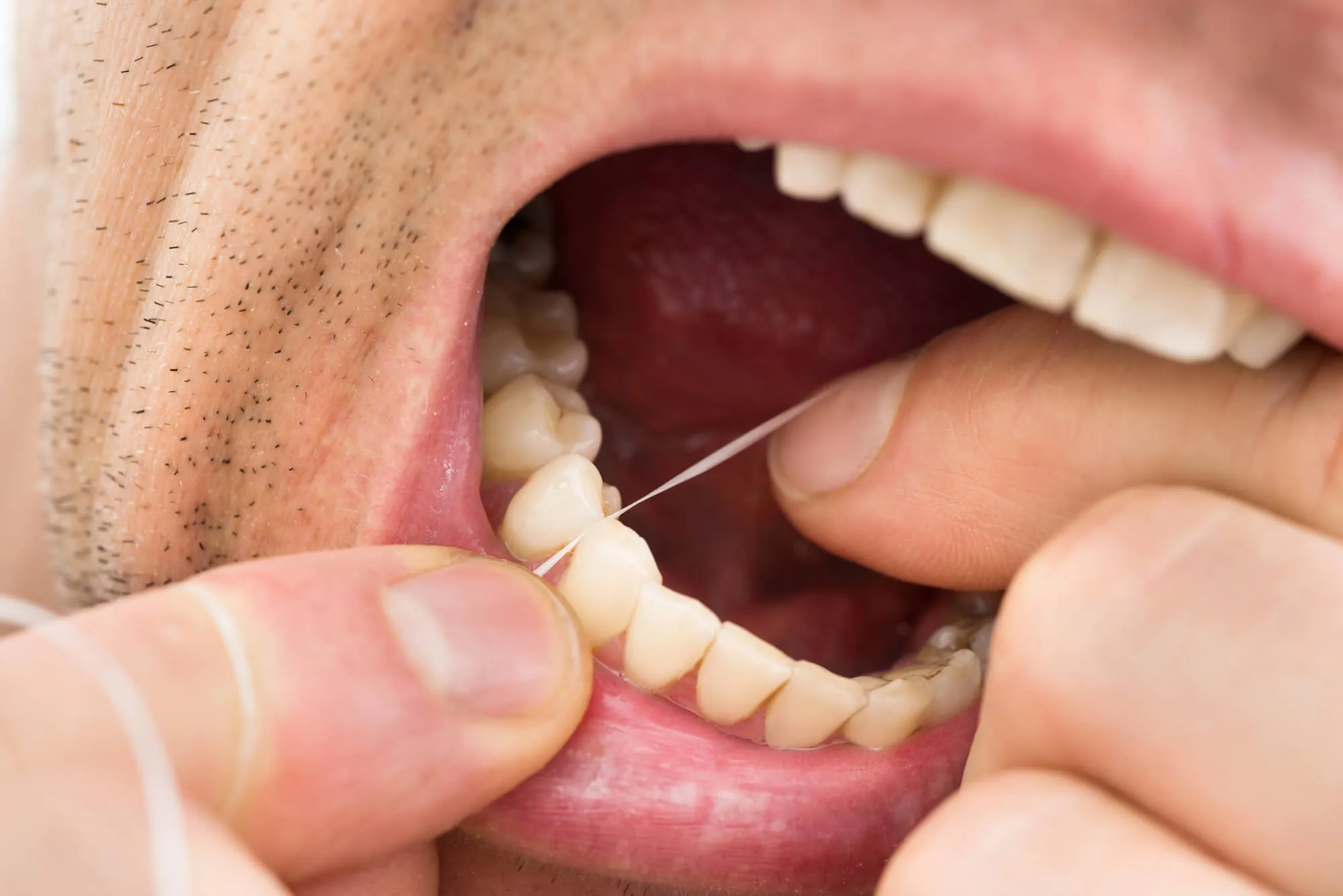 man-flosses-teeth-as-instructed-by-dentist-pembroke-pines-fl
