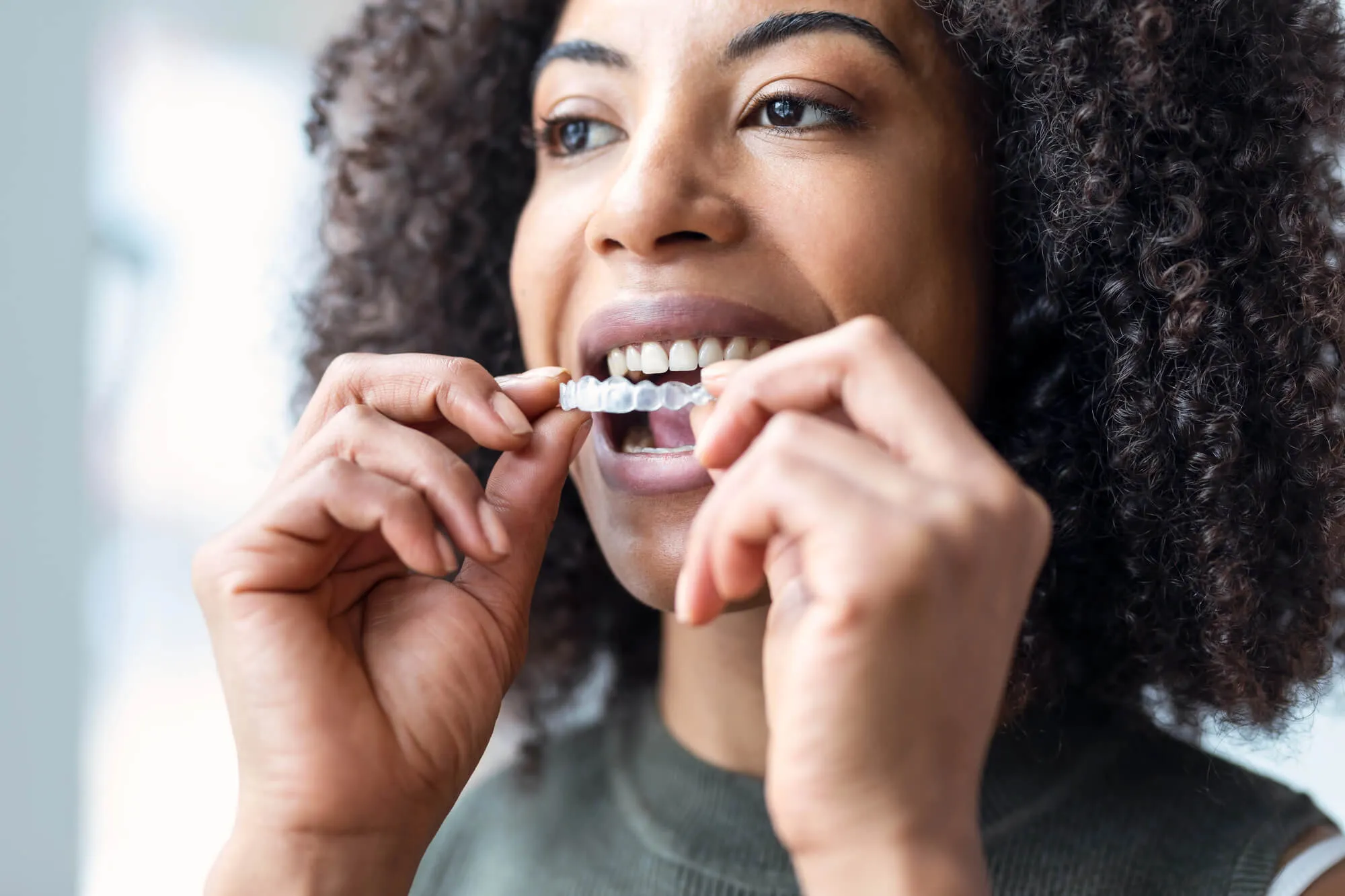 The Invisalign Process: What Each Step Looks Like from Start to Finish ...
