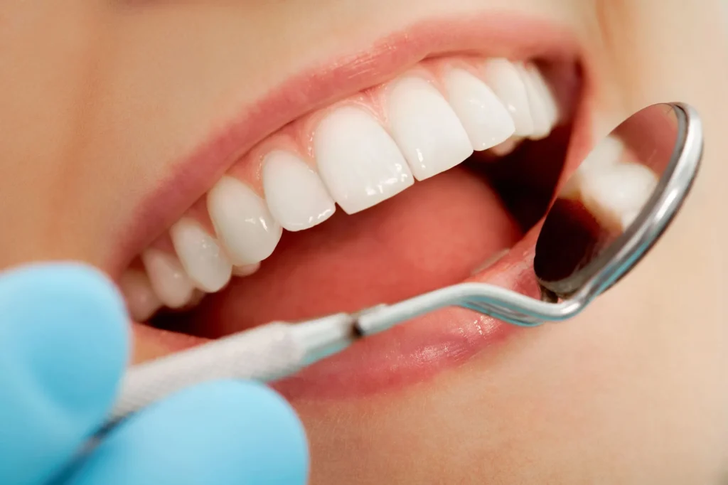 check-up-at-sunrise-dental-center