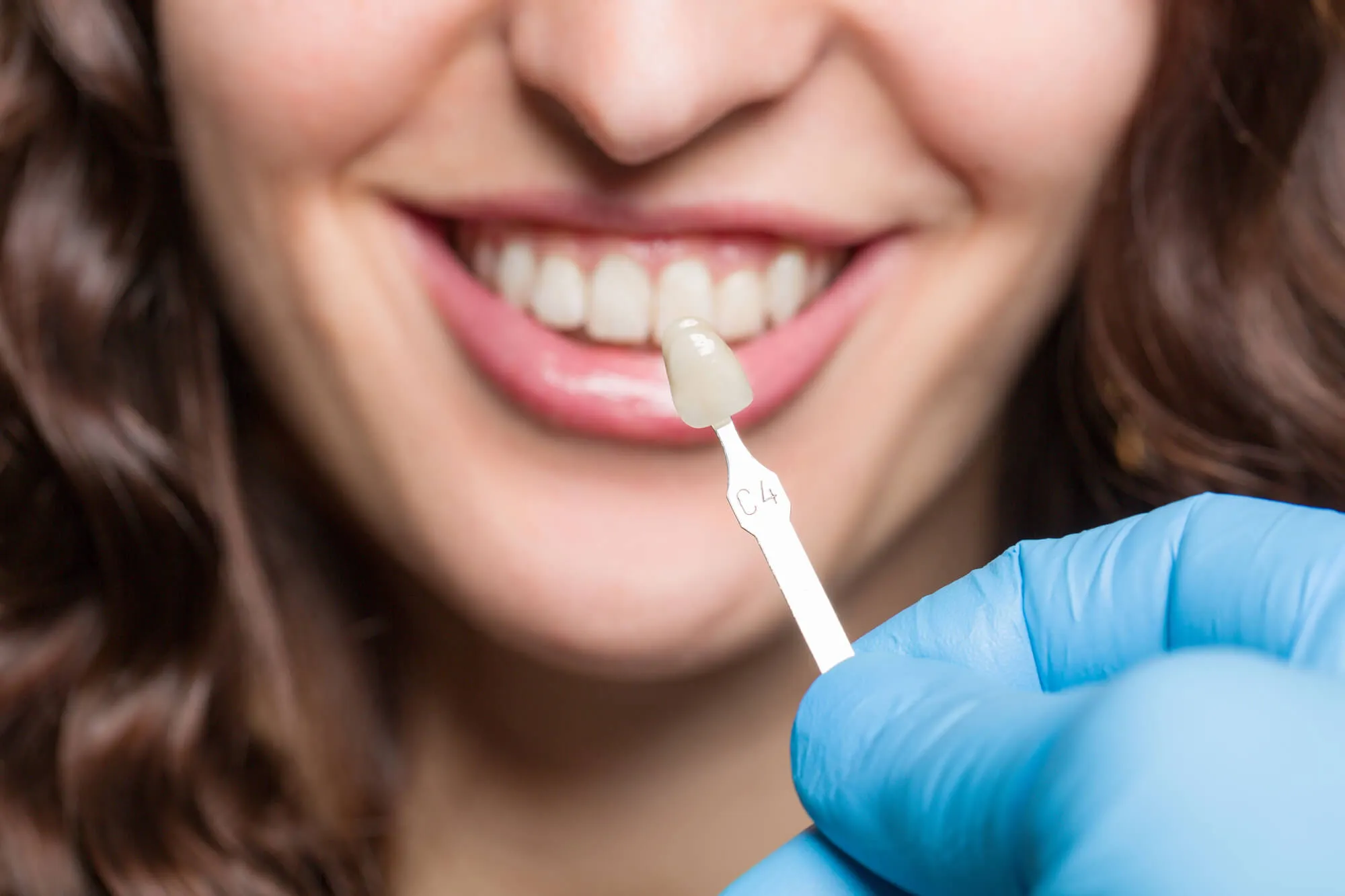 patient-preparing-for-veneers-at-sunrise-dental-center