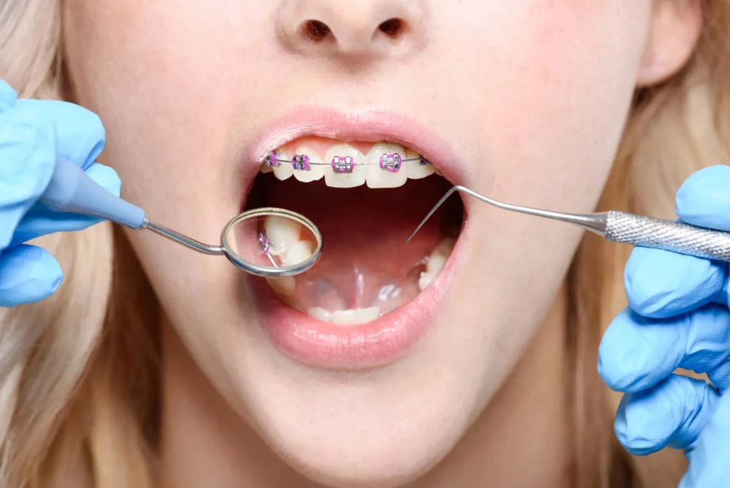 orthodontist in miramar fl checking patient's braces