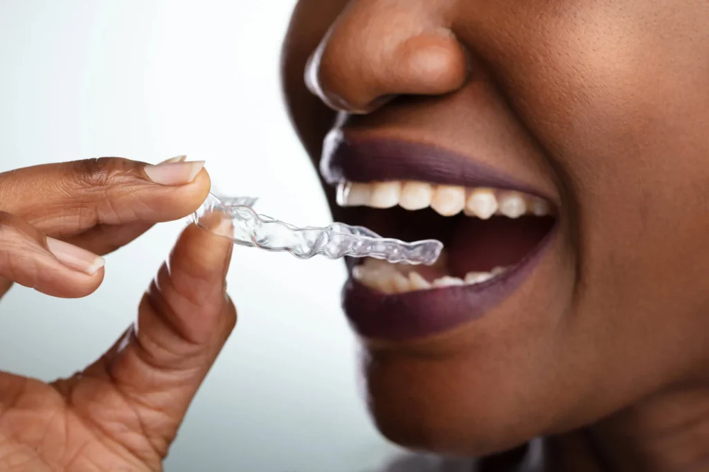 orthodontist sunrise provides patient with clear aligners